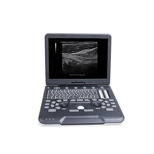 Ecografo portatile - Apogee 1000 - SIUI - per ecografia multidisciplinare / con doppler a colori