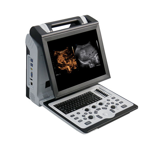 Ecografo portatile - Apogee 2300 Pro - SIUI - per ecografia multidisciplinare / per ecografia urologica / per ecografia muscolo-scheletrica