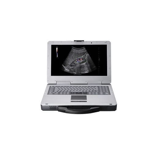 Ecografo portatile - Apogee 1000 Plus - SIUI - per ecografia multidisciplinare / con doppler a colori / in bianco e nero