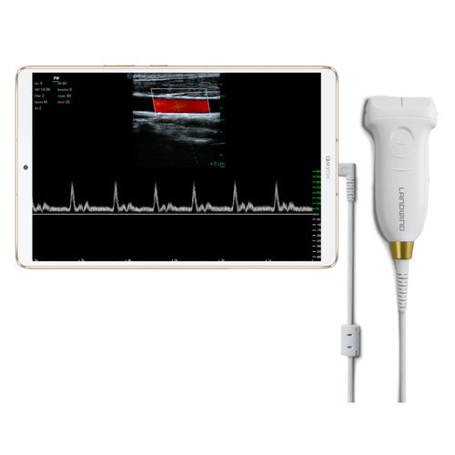 Ecografo palmare - Umagic S - Landwind Medical - per ecografia multidisciplinare / in bianco e nero / con doppler a colori
