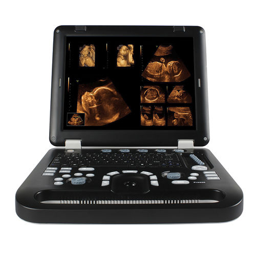 Ecografo portatile - CMS1700A - Sino-Hero - per ecografia multidisciplinare / in bianco e nero / 3D/4D