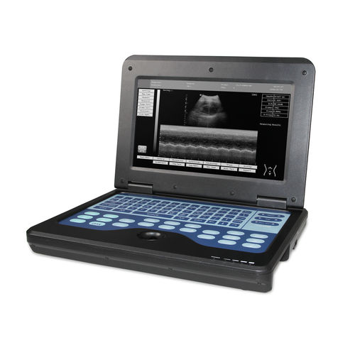 Ecografo portatile - CU-10 - Sino-Hero - per ecografia multidisciplinare / in bianco e nero / con console integrata