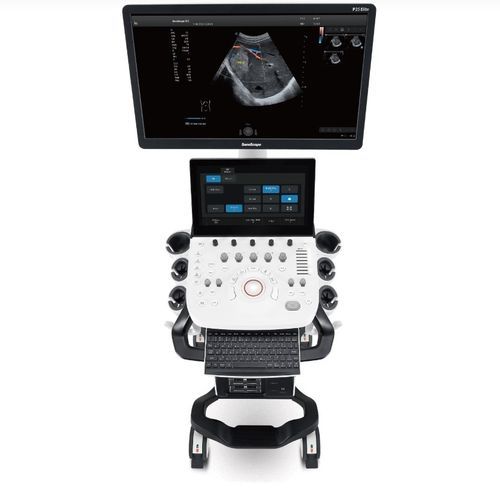 Ecografo su piattaforma - P25 Elite - SonoScape - per ecografia ginecologica ed ostetrica / per ecografia addomino-pelvica / per ecografia cardiovascolare