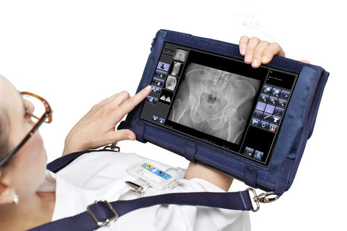Sistema di acquisizione per radiografia - Nomad DReam - Stephanix - portatile
