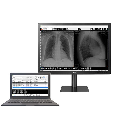 Software per radiologia - Med Diag - Stephanix - di gestione / di visualizzazione / diagnostico