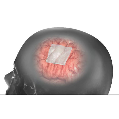 Protesi di sostituzione della dura madre tendine calcaneale bovino - DuraMatrix  - Stryker