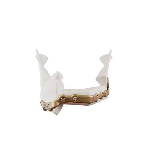Placca di compressione per mandibola - Facial iD - Stryker - bloccata / in metallo