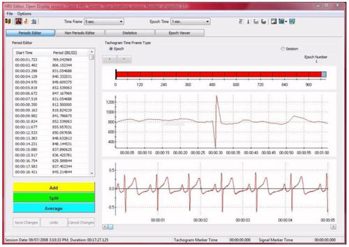 Modulo software per elettrofisiologia - CardioPro Infiniti - Thought Technology - di analisi