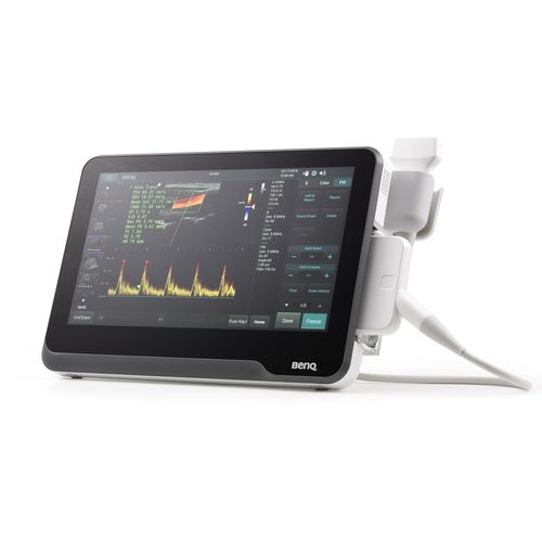 Ecografo portatile - T3300 - BenQ Medical Technology - per ecografia multidisciplinare / in bianco e nero / con doppler a colori