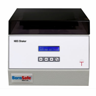 Lettore di micropiastre ad assorbanza - NBS - Tulip Diagnostics - diagnostico