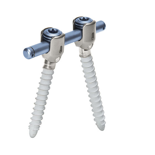 Sistema di osteosintesi toraco-lombo-sacrale - cosmicMIA™ - ulrich medical - via posteriore / per adulti