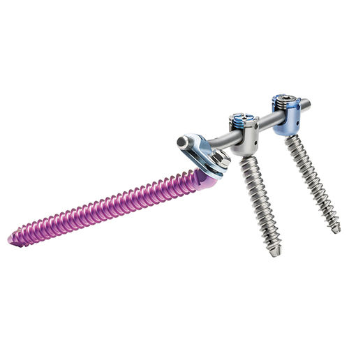 Sistema di osteosintesi sacroiliaca - uBase™ - ulrich medical - via posteriore / per adulti