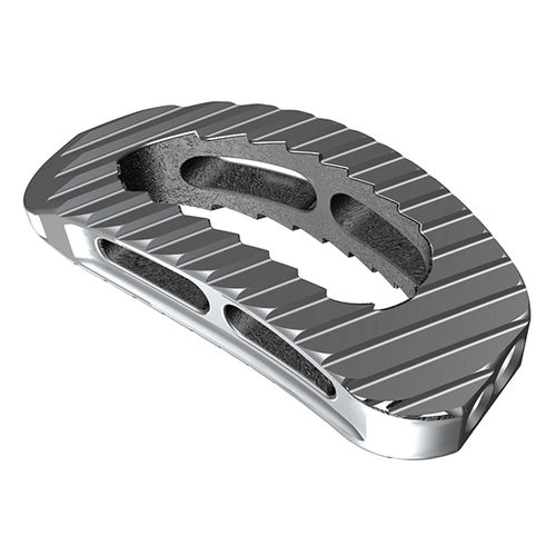 Gabbia intersomatica lombare - tezo-T™ TLIF - ulrich medical - via laterale / in titanio