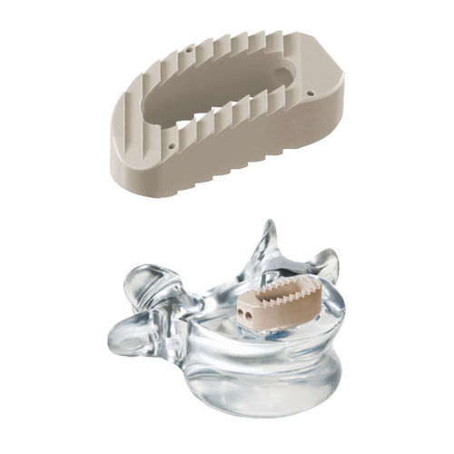Gabbia intersomatica lombo-sacrale - pezo™ - ulrich medical - via laterale / in PEEK