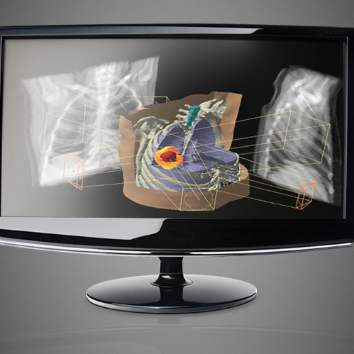 Software di pianificazione del trattamento - Eclipse™ - Varian Oncology - di controllo / d’importazione / di apprendimento automatico