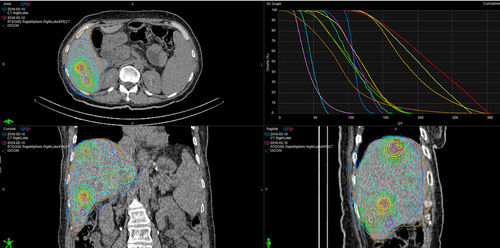 Software di trattamento - RapidSphere - Varian Oncology - con sistema di tracciatura / di modelizzazione / di riconoscimento dei contorni