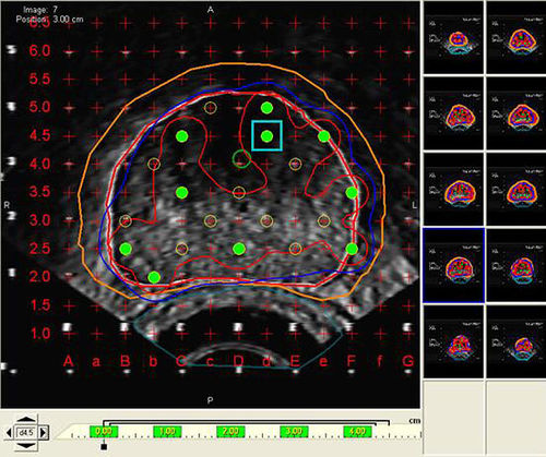 Software di visualizzazione - VariSeed™  - Varian Oncology - di pianificazione del trattamento / d’importazione / medico