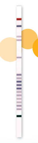 Striscia analitica di HCS - StripAssay® - ViennaLab Diagnostics  - genetica / di sangue / con analisi DNA