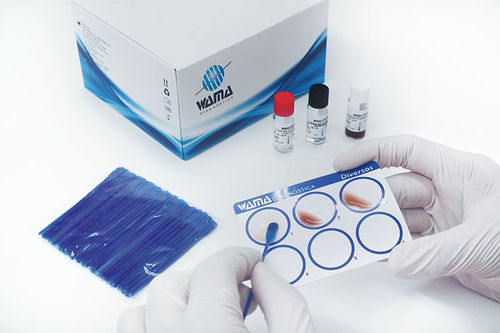 Reagente in soluzione - Wama Diagnostica - da laboratorio / d'IgG / del fattore reumatoide