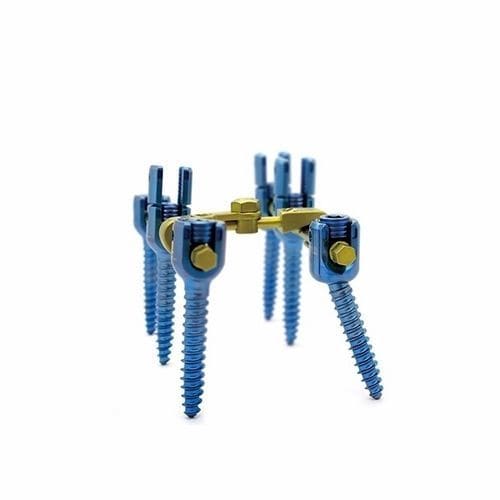 Sistema di osteosintesi toraco-lombo-sacrale - Double Medical Technology - via posteriore / per adulti