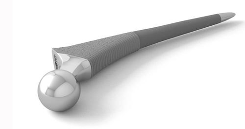 Stelo femorale non cementato - PBG - Double Medical Technology