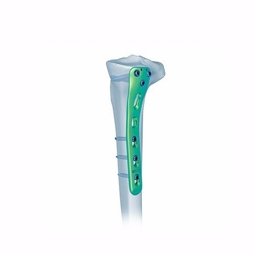 Placca di compressione per tibia - Double Medical Technology - prossimale / posteromediale / bloccata
