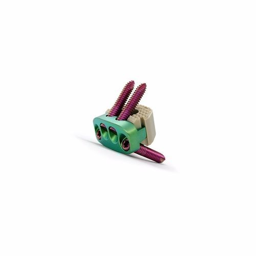 Gabbia intersomatica cervicale - Double Medical Technology - via anteriore