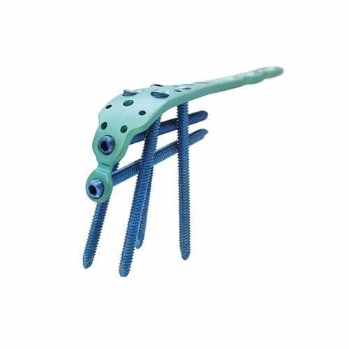 Placca per osteotomia per ulna - Double Medical Technology - per olecrano / prossimale / bloccata