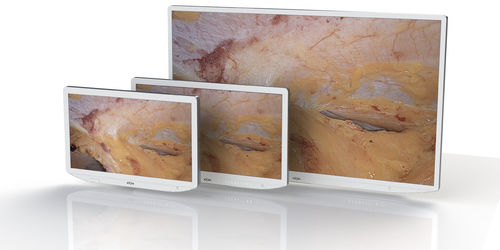 Monitor chirurgico - XION medical - 32" / 27" / 23,8"