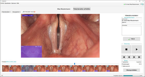 Software di analisi - Phoniatrics - XION medical - medico / per endoscopia / ORL