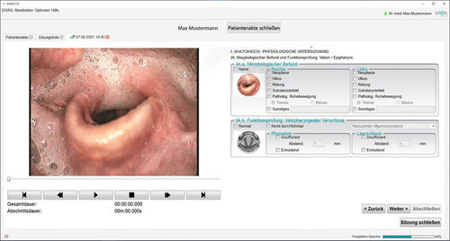Software diagnostico - Dysphagia - XION medical - di valutazione / medico / per visita medica
