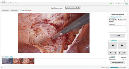 Software medico - DiVAS  - XION medical - per endoscopia / per sala operatoria / di analisi