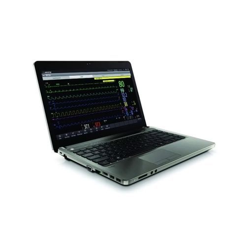 Software visualizzatore - BeneVision CMS  - Mindray North America - di gestione del workflow ECG in linea / di allarme / per cartelle cliniche elettroniche