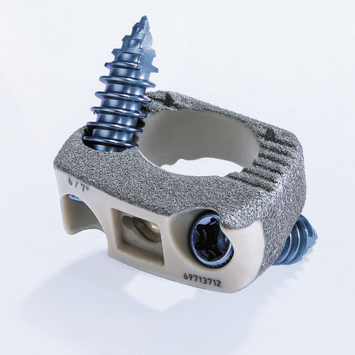 Gabbia intersomatica cervicale - ArcadiusXP C® - Aesculap® - via anteriore