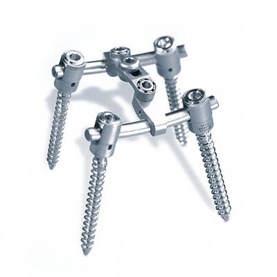 Sistema di osteosintesi toraco-lombare - S4®   - Aesculap® - via posteriore / per adulti