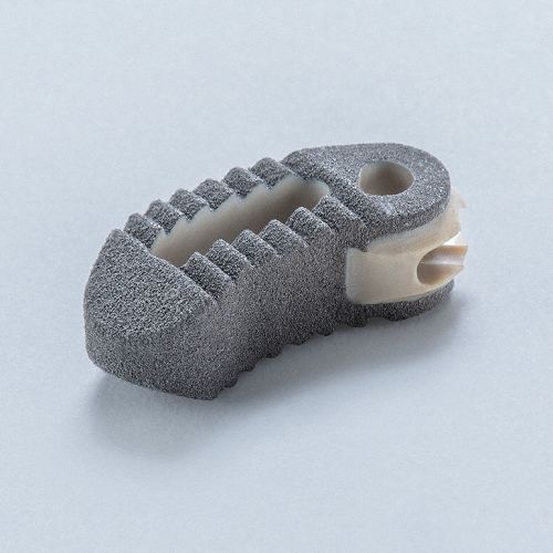 Gabbia intersomatica lombare - TSPACE®XP - Aesculap® - via transforaminale
