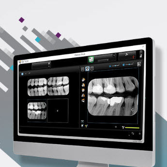 Software odontoiatrico - CS Imaging version 8 - Carestream Dental - per imaging odontoiatrico / di analisi delle immagini / di gestione dati