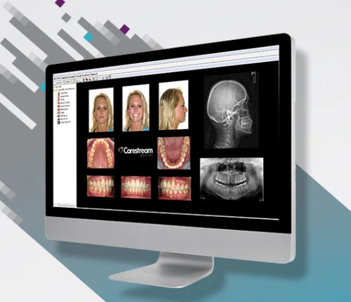 Software di visualizzazione - CS Orthodontic Imaging Software - Carestream Dental - di gestione dati / di gestione dati dei pazienti / diagnostico