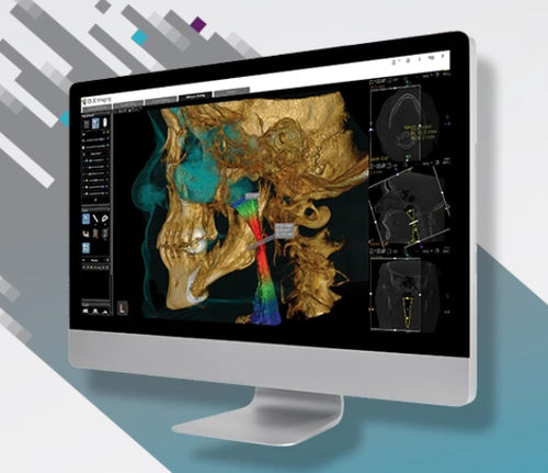Modulo software odontoiatrico - CS Airway Module - Carestream Dental - per diagnostica per immagini / per tomografia computerizzata / per imaging odontoiatrico