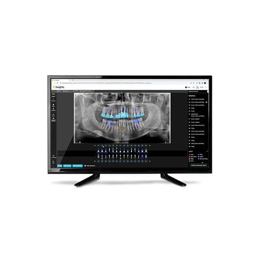 Software di analisi - AI Insights - Carestream Dental - diagnostico / per reportistica / di analisi delle immagini