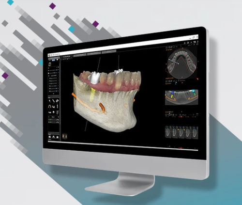Software di visualizzazione - CS 3D - Carestream Dental - di analisi / di gestione dati dei pazienti / diagnostico