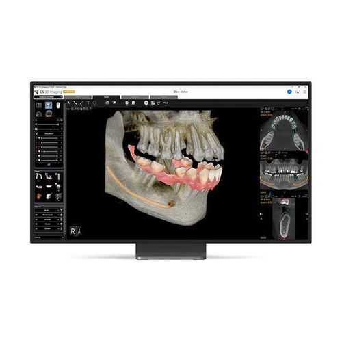 Software clinico - CS 3D Imaging Premium - Carestream Dental - odontoiatrico / per implantologia dentale / per chirurgia odontoiatrica
