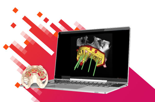 Software di gestione dati - Stackable - Carestream Dental - di gestione de telecollaborazione / di progettazione / di pianificazione