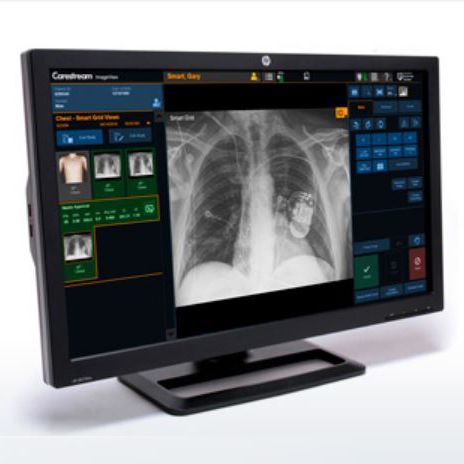 Software per diagnostica per immagini - ImageView - Carestream - di analisi / di controllo / per controllo di infezioni
