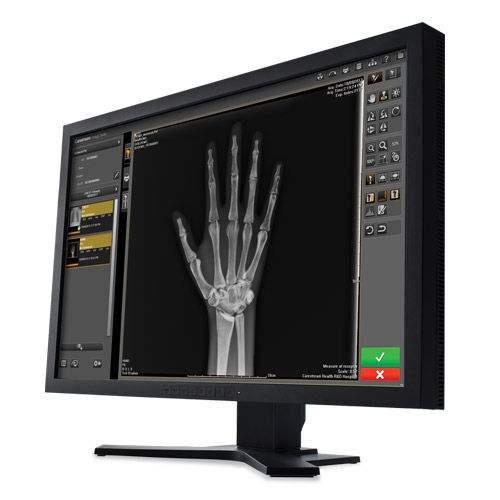 Software per diagnostica per immagini - Image Suite V4 - Carestream - di analisi / di gestione / di visualizzazione