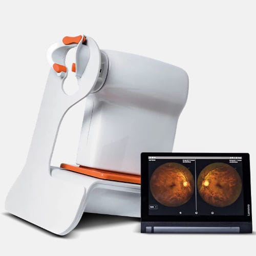 Telecamera retinica non-midriatica - Nexy A.I. - Visionix