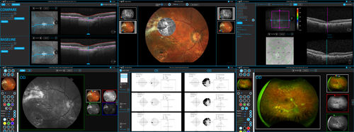 Software per ospedale - AXIS™ - Sonomed Escalon - per cartelle cliniche elettroniche / per oftalmologia / di analisi