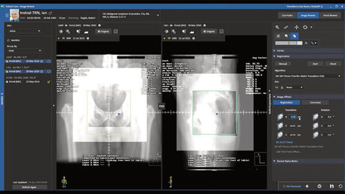 Software per diagnostica per immagini - MOSAIQ® 3 - Elekta - di oncologia / di analisi delle immagini / didattico