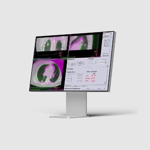 Software di gestione - Elekta - di visualizzazione / di trattamento / con sistema di tracciatura