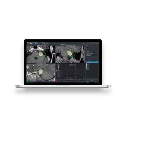 Software clinico - Leksell GammaPlan® - Elekta - per tomografia computerizzata / per DICOM / TEP